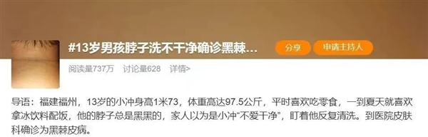 脖子总是黑黑的洗不干净 这可能是身体在“求救”-萌图百科