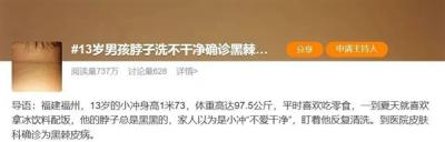 脖子总是黑黑的洗不干净 这可能是身体在“求救”-萌图百科