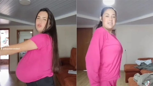 巴西女子患“巨乳症”失控！短短几月长O杯 出行得坐轮椅