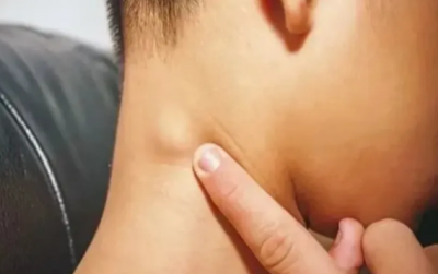 5岁男孩脖子长小疙瘩确诊癌症晚期 医生提醒-萌图百科
